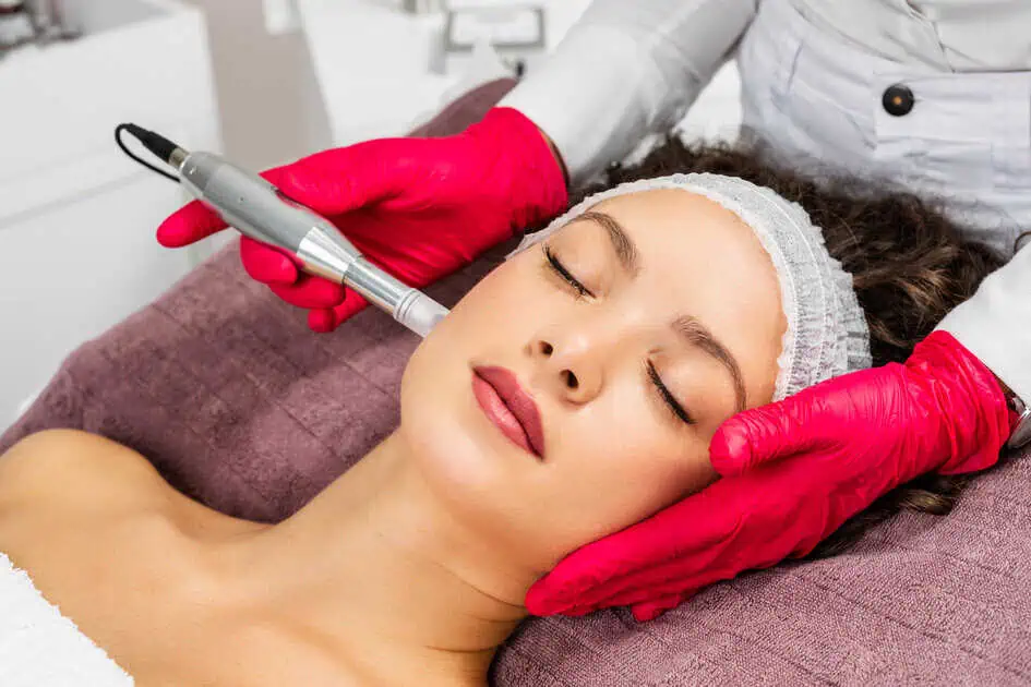 Microneedling with PRP by W Aesthetics in Austin,TX