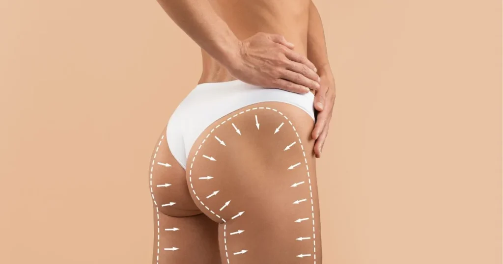 Non-Surgical Butt Lift area on a woman's body, showing arrows for contouring and lift, promoting a sculpted shape in Austin, TX