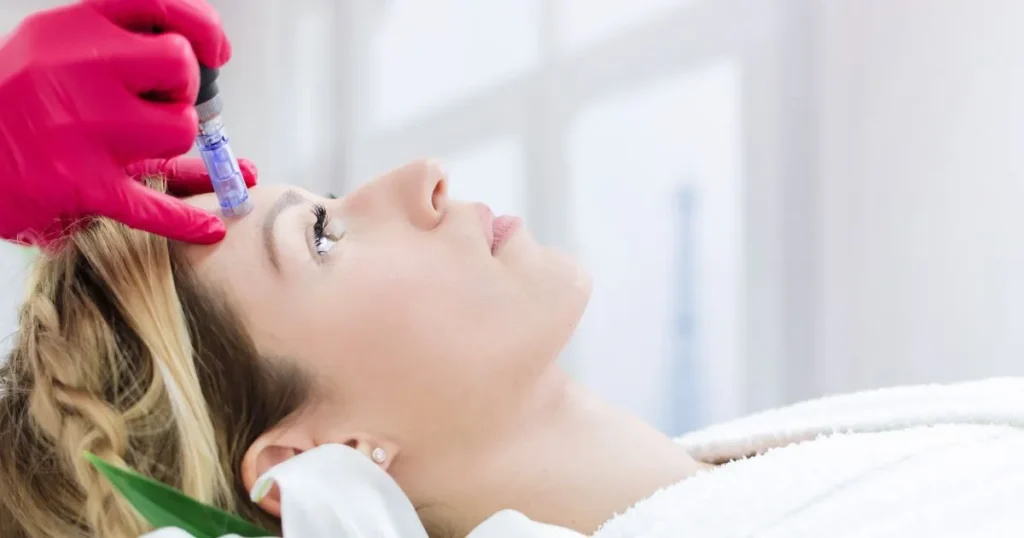A woman receiving microneedling treatment on her forehead in Austin, TX