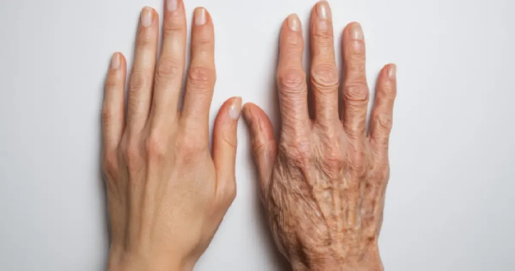 What Is Hand Rejuvenation and How Does It Work?