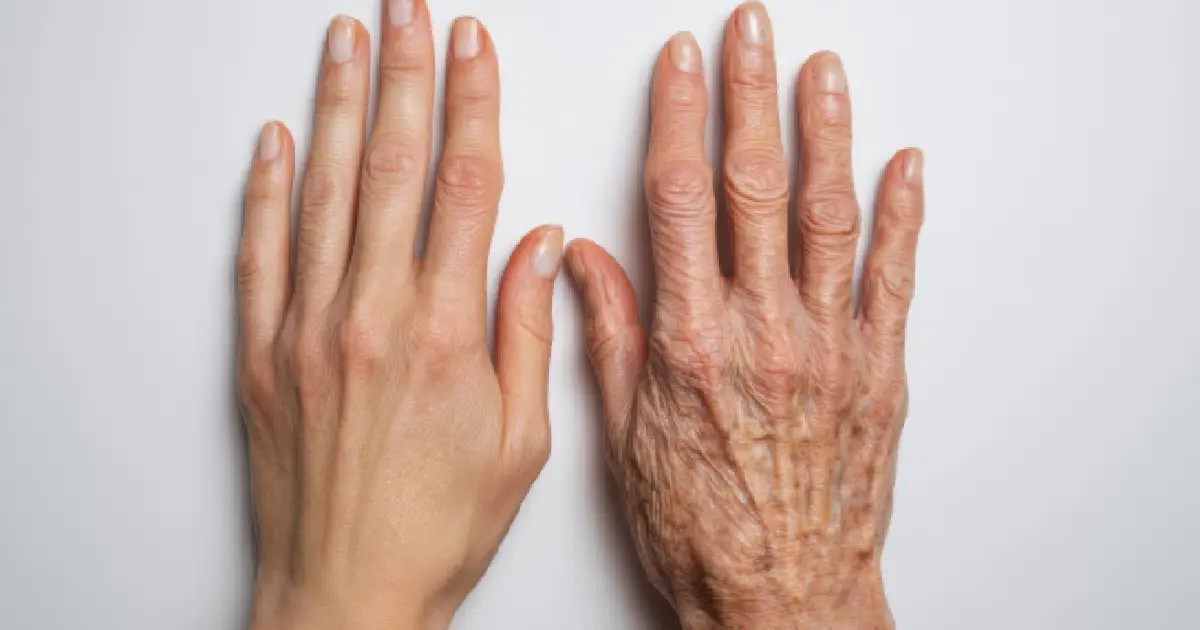 What Is Hand Rejuvenation and How Does It Work?